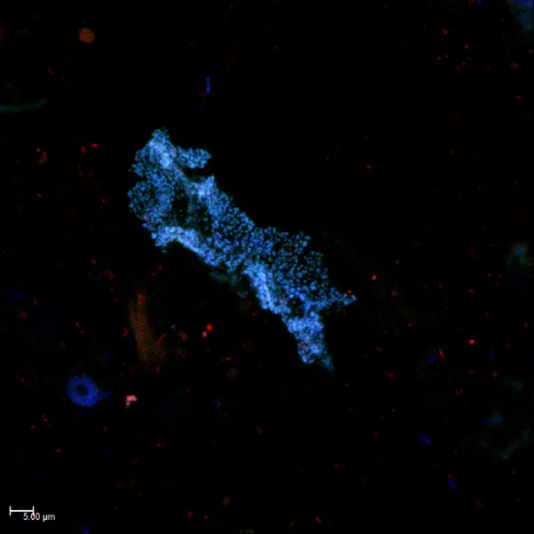 Methanogene Archaeen